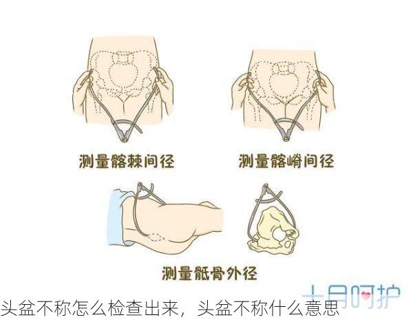 头盆不称怎么检查出来，头盆不称什么意思